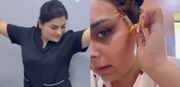 Qeyri-etik görüntüləri yayılan “Dr. Gülü” daha bir pasiyenti yarıcan qoyub? - Video