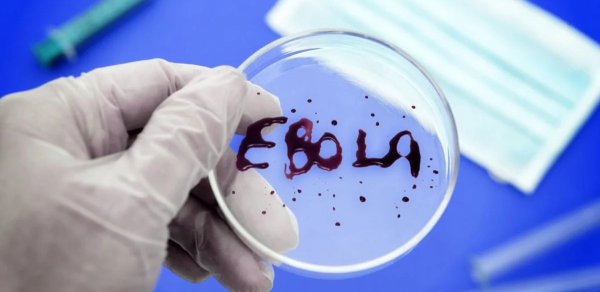 ÜST: "Ebola virusu sürətlə yayılır"