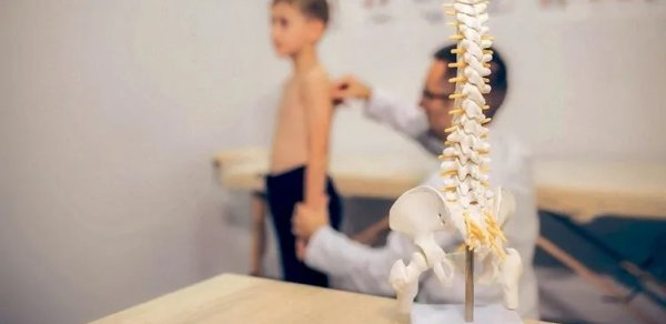 Mütəxəssislər xəbərdarlıq edir: Skoliozun ən kritik dövrü bu yaş arasıdır