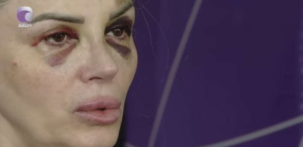 Bakıda mağazada döyülən qadın danışdı: “Demişdi ki, səni doğrayacağam” - VİDEO