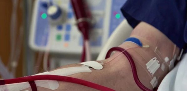 Dializ xəstəsinin virusa yoluxduğu iddia olunur: "Səhhəti onsuz da risk altındadır" - VİDEO
