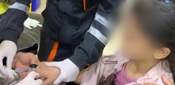 Barmağında üzük sıxılı qaldı: Belə xilas olundu