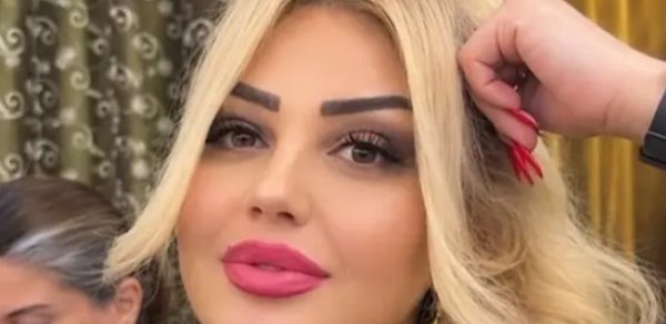Bakıda qadın dişini çəkdirdiyinə görə vəfat edib? - Video