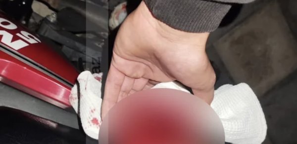 Bakıda VAZ-2107 11 yaşlı uşağı vurub qaçdı, polis yaxaladı - FOTO