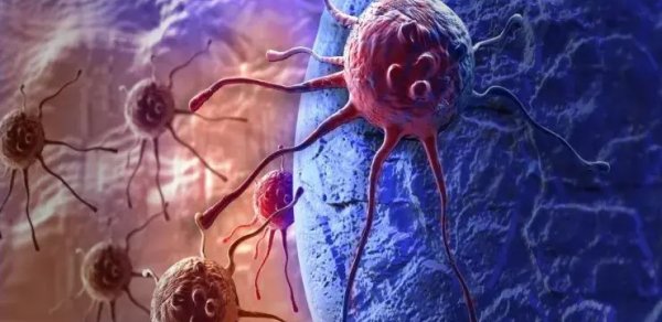 Süni intellekt beyin xərçənginə qarşı yeni ümid yaratdı