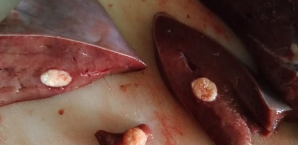 Vətəndaşın aldığı ciyərdə ağ düyünlər aşkarlandı: Qida ekspertindən açıqlama