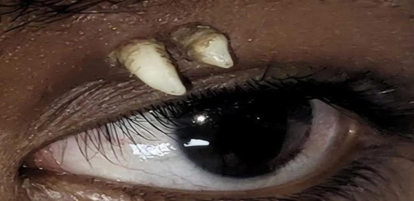 16 yaşlı oğlanın gözündən diş çıxdı - Foto