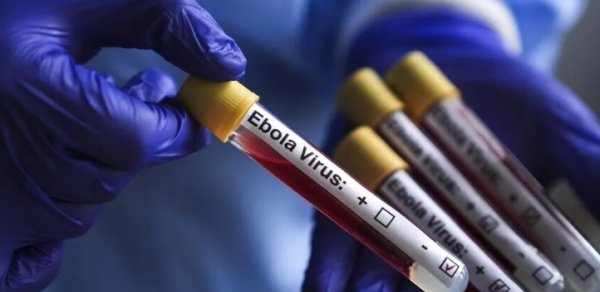 Konqoda Ebola faciəsi: Ölənlərin sayı 4 887-yə çatdı