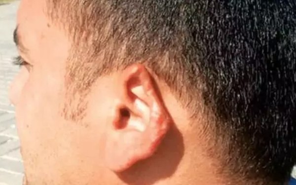 Əri ilə dalaşan qadın onun qulağını qopardı