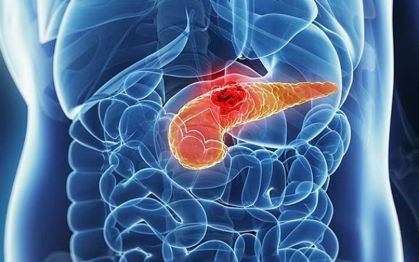 Xərçəngin bu növü müalicə olunacaq - Ömürü ikiqat uzadacaq