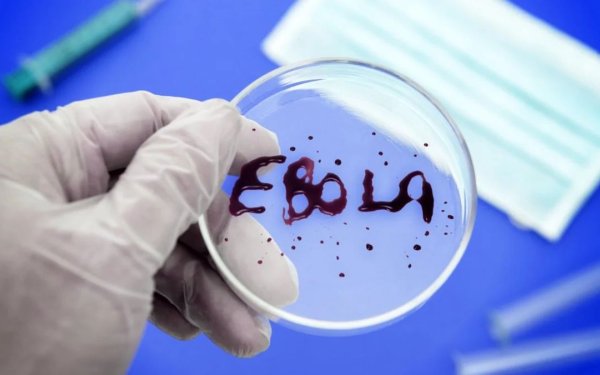 ÜST: "Ebola virusu sürətlə yayılır"