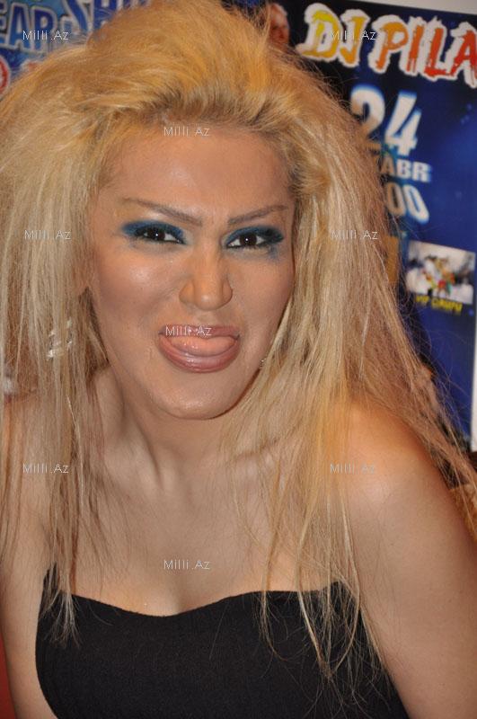 Plastik əməliyyatdan sonra Rəqsanə (FOTO)