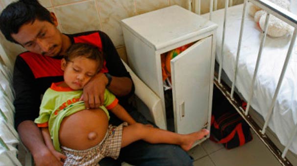 ŞOK! 3 yaşlı oğlan uşağının qarnında körpə tapıldı - FOTO