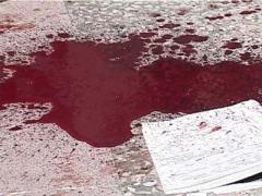 Polkovnikin 12 yaşlı oğlunun başını kəsdilər