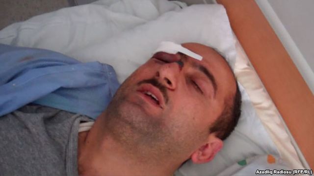 ARDNŞ jurnalisti döyənləri işdən qovacaq