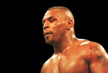 Mayk Tayson boynundan əməliyyat olundu