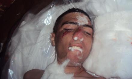 Nazirlikdən əsgərin ölümü ilə bağlı yeni açıqlama - RƏSMİ