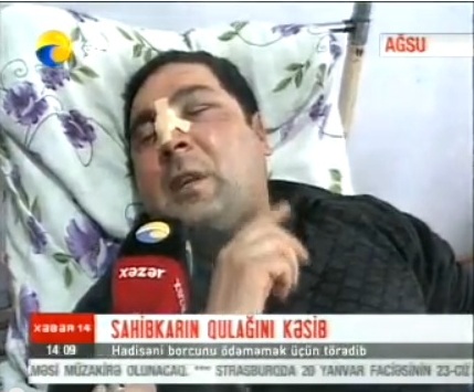 Azərbaycanda sahibkarın qulağını kəsdilər - VİDEO