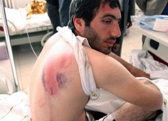 Şagirdlərini qorumaq istəyən müəllimi polislər bu günə saldı – FOTOLAR