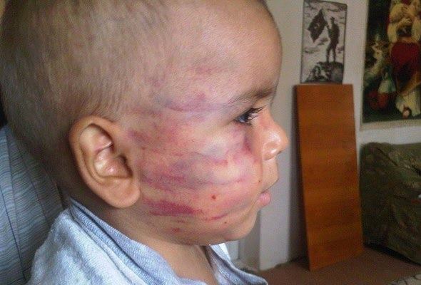 ‘Facebook’da Bakıda vəhşicəsinə döyülən körpənin fotosu yayımlandı -  FOTO 