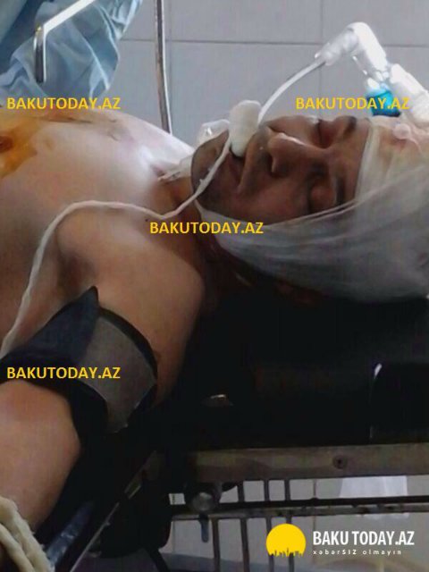 Hüseyn Dəryanın xəstəxanadakı son şəkilləri yayıldı -  FOTOLAR 