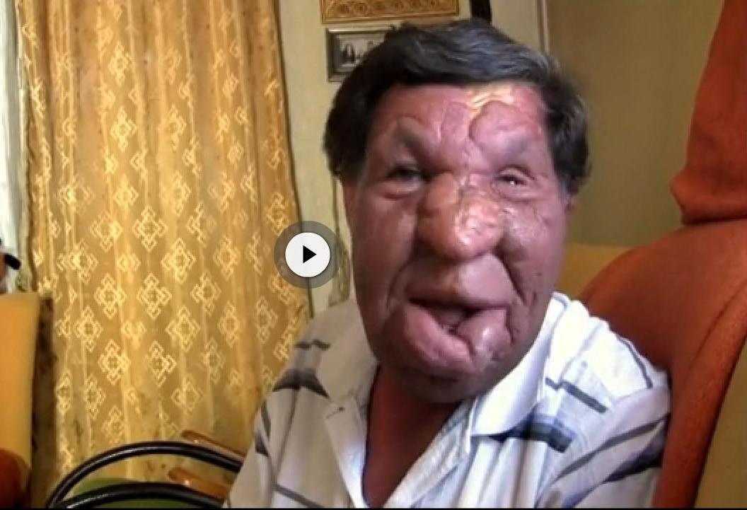 Sosial şəbəkədə bir şəkillə məşhurlaşan üzüxallı adamın ailəsindən -  REPORTAJ 