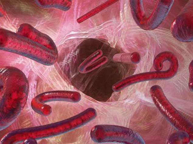 Ebola viruslu tələbələr Azərbaycanda... – AÇIQLAMA