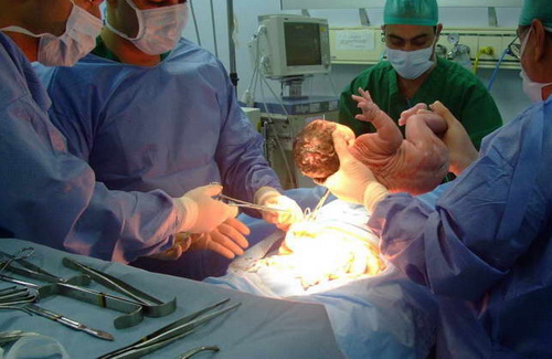 25 yaşlı ana doğuş zamanı öldü