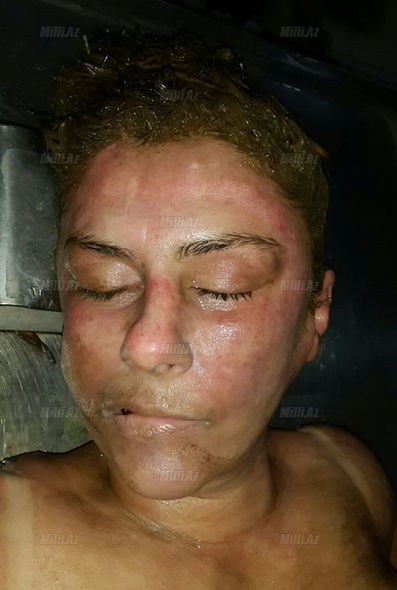 Dövlət Bayrağı Meydanının ərazisindən qadın meyiti tapıldı – FOTO