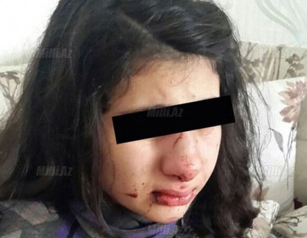 Bakıda məktəblini döyən manyak onu zorlamaq istəyib – TƏFƏRRÜAT
