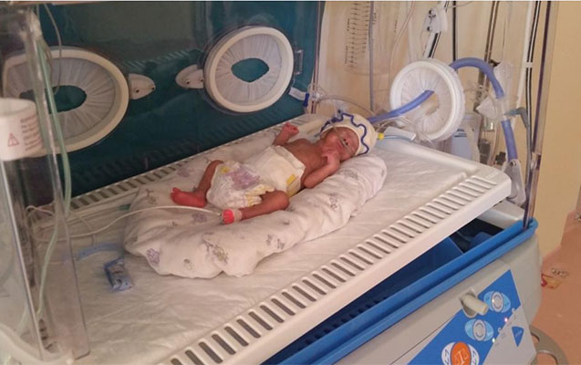 650 qram çəkidə doğulan uşaq xilas edildi- FOTO