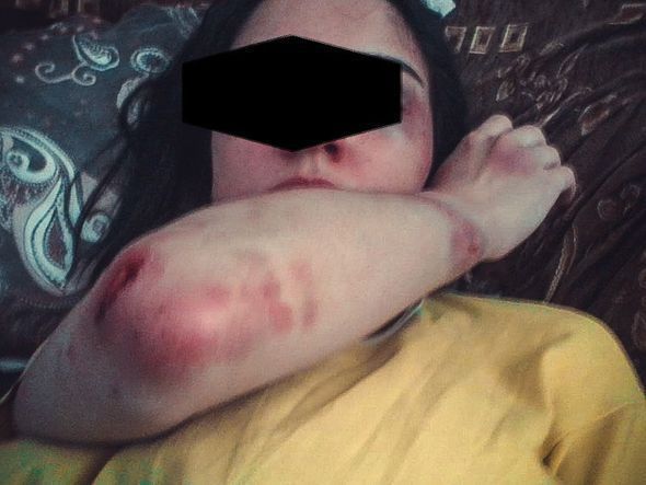 Sabunçuda hamilə qadını döyən kişi həbs olundu – FOTO