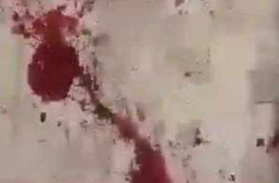 Nardaranda yaralananların son durumu -  Nazirlikdən açıqlama