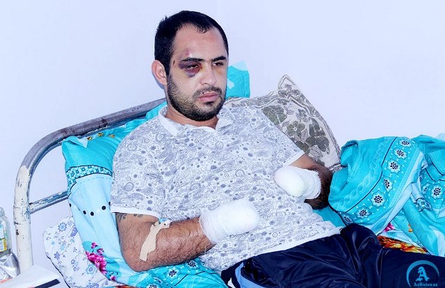 2 vəhhabiyə cinayət işi açıldı -  Oğlanın əllərini baltaladıqları üçün