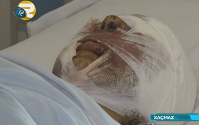 Çaqqal sürüsü qadına hücum etdi - Video