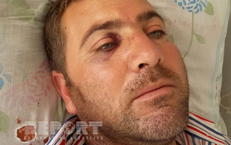 2 məcburi köçkün ailəsi arasında kütləvi dava -  FOTO