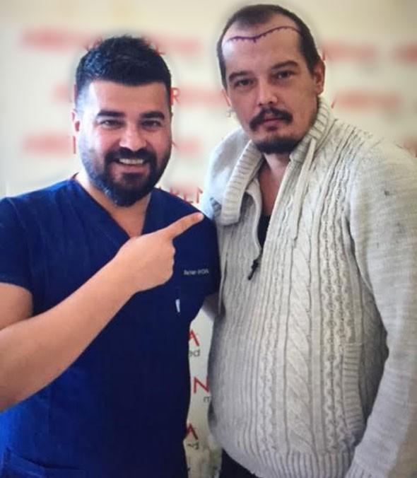 “Türkiyənin Leonardo Di Kapriosu” saç əkdirir - FOTO