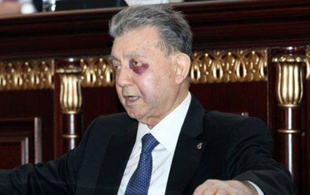 Akif Əlizadəyə nə olub? - Özü danışdı 