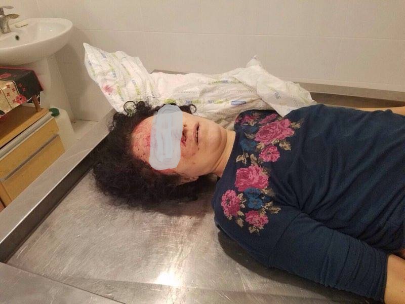 Bakıda dəhşətli hadisə: qadın özünü körpüdən atdı - FOTO