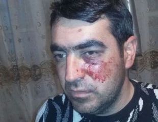 Gəncənin Nizami polisinin rəisindən nazirə şikayət: "Həyat yoldaşımın gözü önündə məni döydülər"
