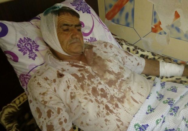 İmişlidə ata və üç oğlu döyüldü – FOTO