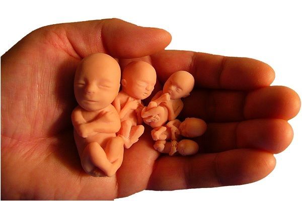 Azərbaycanda 19 məktəbli qız abort etdirib