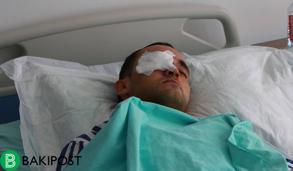 Azərbaycanda oğlanı qıza görə döyüb gözünü kor elədilər