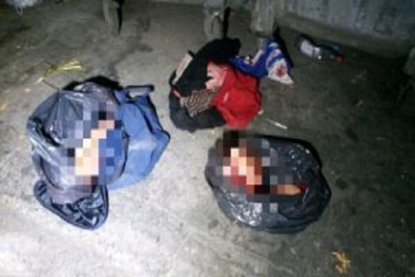 Bakıda doğranmış insanın sifət görüntüsü yayıldı - FOTO