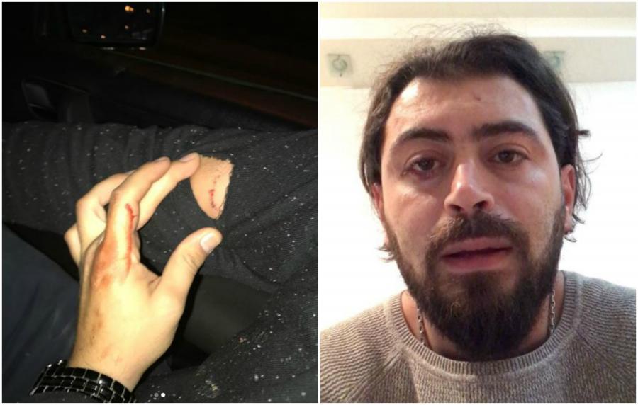 Küçə itləri azərbaycanlı reperə hücum etdi - Foto