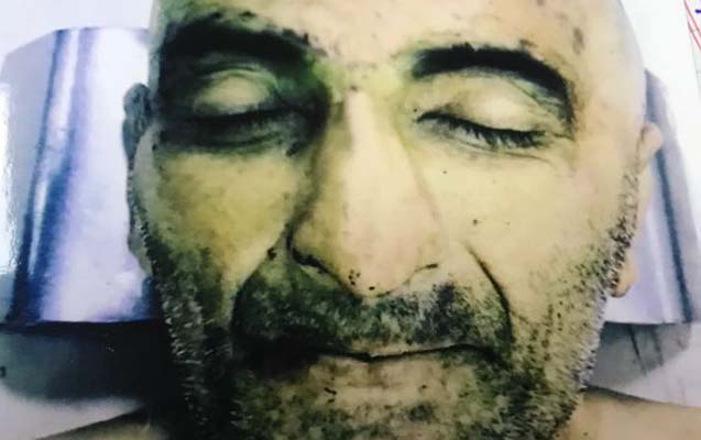 Bakıda naməlum meyit tapıldı - Bu kişinin yaxınları axtarılır