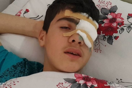 Azərbaycanda dərsdən evə qayıdan məktəbli güllə yarası aldı