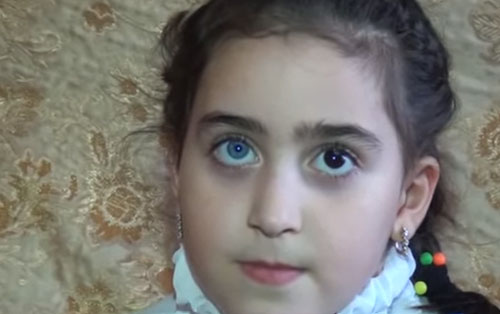 6 yaşlı Zəhranın gözlərinin biri göy, digəri qaradır - Dünyada nadir hadisə+ Video