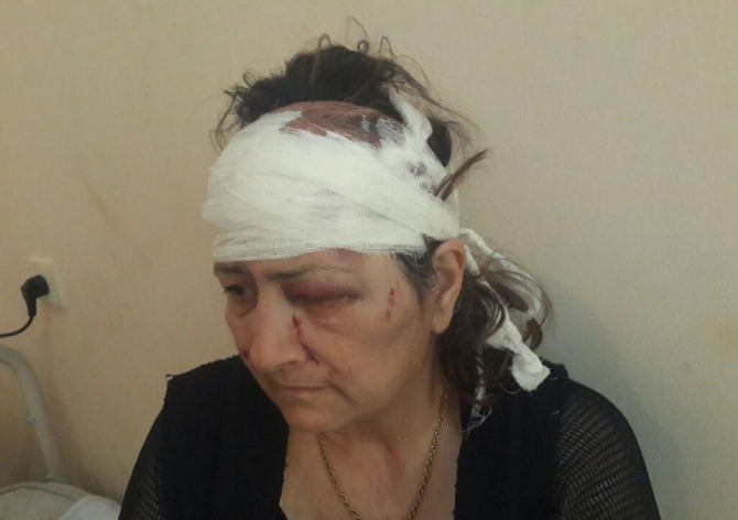 Azərbaycanda qayınana kürəkəni tərəfindən döyüldü