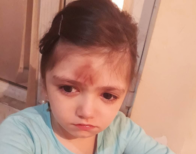 Bakıda birinci sinif şagirdini döyən müəllim işdən çıxarıldı
